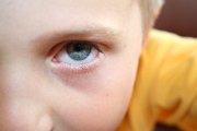 IMG_9744